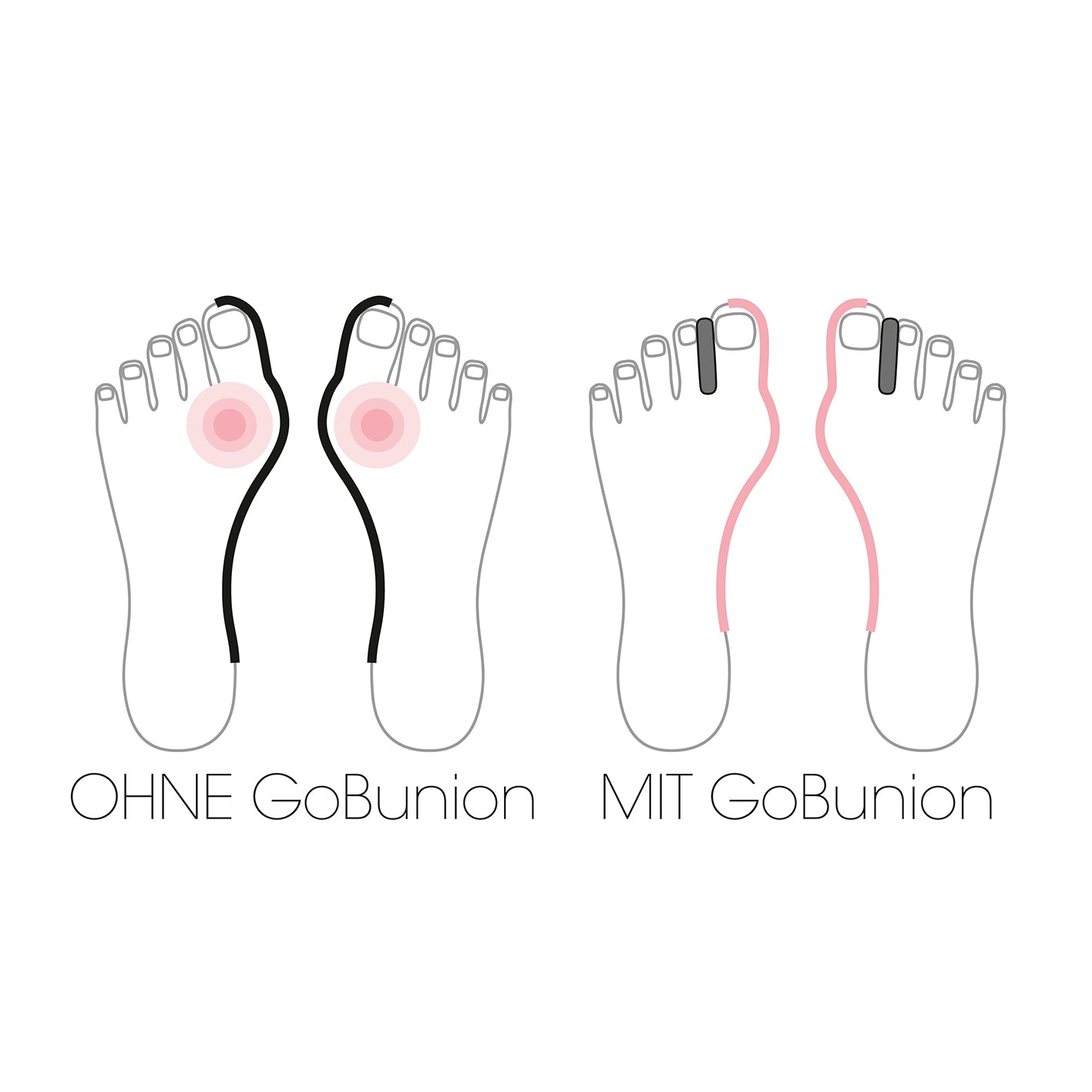 Gobunion Hallux Fütlinge with integrated toe spreader, size 35-38