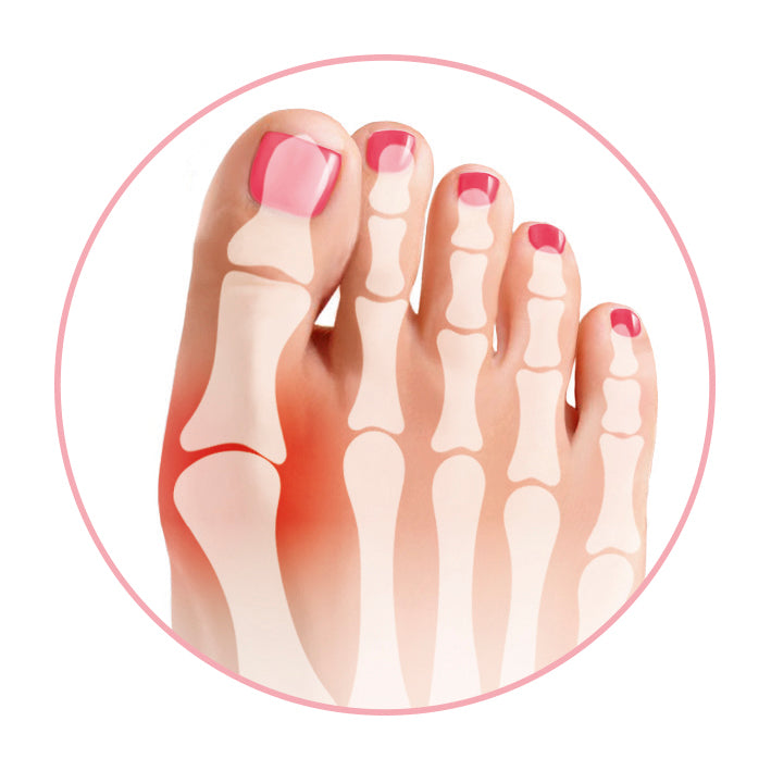 Gobunion Hallux Fütlinge with integrated toe spreader, size 35-38